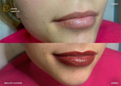 Maquillage permanent lèvres Candy Lip | Marie Tatoo | Toulouse